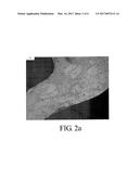 BIOERODIBLE MAGNESIUM ALLOY MICROSTRUCTURES FOR ENDOPROSTHESES diagram and image