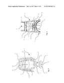 VALVE UNIT INCLUDING A MECHANICAL COUPLER diagram and image