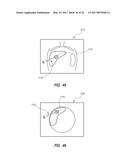 Systems and Methods for Guiding a Medical Instrument diagram and image