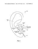 EARPHONE HAVING A CONTROLLED ACOUSTIC LEAK PORT diagram and image