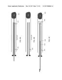 MECHANICAL THROMBECTOMY APPARATUSES AND METHODS diagram and image