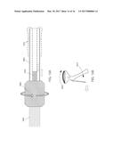 MECHANICAL THROMBECTOMY APPARATUSES AND METHODS diagram and image