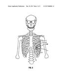 Thoracic Access Port Including Foldable Anchor diagram and image