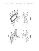 Thoracic Access Port Including Foldable Anchor diagram and image