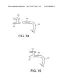 IMPLANT FIXATION DEVICES AND METHODS OF USING THE SAME diagram and image