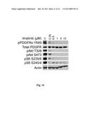 PLATELET-DERIVED GROWTH FACTOR RECEPTOR MUTATIONS AND COMPOSITIONS AND     METHODS RELATING THERETO diagram and image