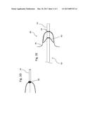 SYSTEM FOR A WIRE-LUMEN FREE BALLOON CATHETER diagram and image