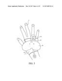 CATHETER FIXING BAND diagram and image