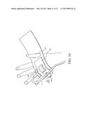 CATHETER FIXING BAND diagram and image