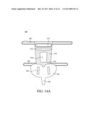 CATHETER FIXING BAND diagram and image