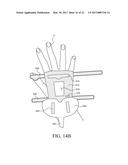 CATHETER FIXING BAND diagram and image