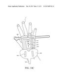 CATHETER FIXING BAND diagram and image