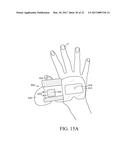 CATHETER FIXING BAND diagram and image