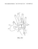 CATHETER FIXING BAND diagram and image