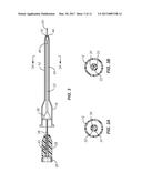 Systems And Methods For Venipuncture And Catheter Placement diagram and image