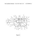 Tire Chain and Components Thereof diagram and image