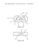 Tire Chain and Components Thereof diagram and image