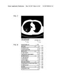 METHOD AND RECORDING MEDIUM diagram and image