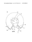 RECOVERY PET COLLAR diagram and image