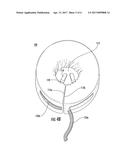 RECOVERY PET COLLAR diagram and image