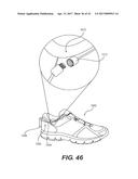 MOTORIZED TENSIONING SYSTEM diagram and image