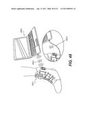 MOTORIZED TENSIONING SYSTEM diagram and image