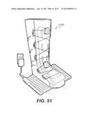 MOTORIZED TENSIONING SYSTEM diagram and image