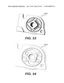 MOTORIZED TENSIONING SYSTEM diagram and image