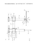 MOVEABLE BONE PLATE IMPLANTATION SYSTEM AND METHOD OF USE diagram and image