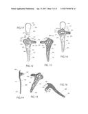ANATOMICAL HUMERAL FIXATION SYSTEM AND METHOD diagram and image