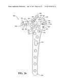 ANATOMICAL HUMERAL FIXATION SYSTEM AND METHOD diagram and image