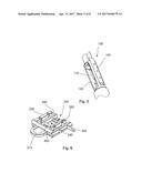 SYSTEM FOR HANDLING AN AUGMENTATION IMPLANT diagram and image