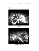 THERAPEUTIC AGENT FOR OCULAR FUNDUS DISEASE diagram and image