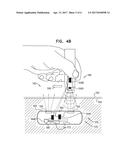 IMPLANT ILLUMINATION diagram and image