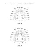 DENTAL APPLIANCE APPARATUS AND RESPIRATORY PERFORMANCE diagram and image