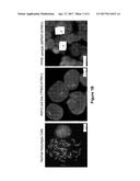 ACTIVATING NTRK1 GENE FUSIONS PREDICTIVE OF KINASE INHIBITOR THERAPY diagram and image