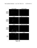 ACTIVATING NTRK1 GENE FUSIONS PREDICTIVE OF KINASE INHIBITOR THERAPY diagram and image