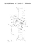 APPARATUS AND METHODS FOR ATTACHING OBJECTS TO TREES diagram and image