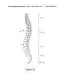 METHODS, SYSTEMS AND DEVICES FOR SPINAL SURGERY POSITION OPTIMIZATION diagram and image