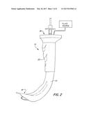 Side Loading Articulating Laryngeal Access System diagram and image