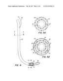 Side Loading Articulating Laryngeal Access System diagram and image