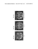 METHOD FOR ACQUIRING T2* AND VASCULAR IMAGES FROM MAGNETIC RESONANCE     IMAGING SYSTEM diagram and image