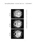 METHOD FOR ACQUIRING T2* AND VASCULAR IMAGES FROM MAGNETIC RESONANCE     IMAGING SYSTEM diagram and image