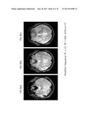 METHOD FOR ACQUIRING T2* AND VASCULAR IMAGES FROM MAGNETIC RESONANCE     IMAGING SYSTEM diagram and image