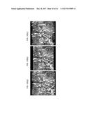 METHOD FOR ACQUIRING T2* AND VASCULAR IMAGES FROM MAGNETIC RESONANCE     IMAGING SYSTEM diagram and image