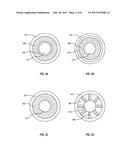 SOLENOID OCCLUSION DEVICE diagram and image