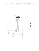 METHOD AND APPARATUS FOR CLOSING A FISSURE IN THE ANNULUS OF AN     INTERVERTEBRAL DISC, AND/OR FOR EFFECTING OTHER ANATOMICAL REPAIRS AND/OR     FIXATIONS diagram and image