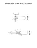 SUTURE ANCHOR MANAGEMENT diagram and image