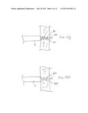 SYSTEMS AND METHODS FOR HELICALLY ADVANCING SUTURE IN TISSUE diagram and image