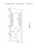 VIBRATION AND INERTIA ENHANCED ATHERECTOMY diagram and image